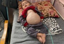 Israël poursuit ses opérations militaires meurtrières à Gaza malgré le cessez-le-feu La famine tue aussi à Gaza.