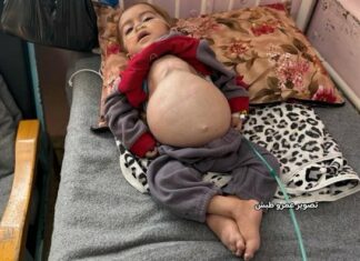 Israël poursuit ses opérations militaires meurtrières à Gaza malgré le cessez-le-feu La famine tue aussi à Gaza.